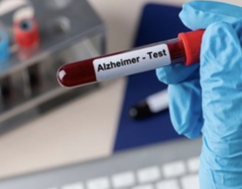 Blood-Based Biomarkers for Memory Loss