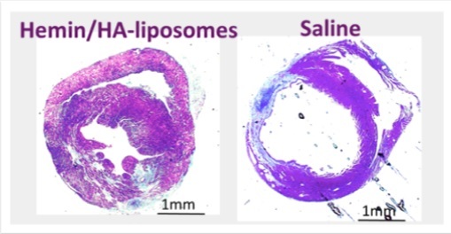 Hemin formulated in hyaluronan liposomes for treating inflammatory diseases  
