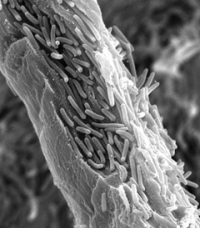 Cytophaga-Microbialtec Research