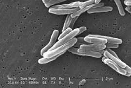 New method to test tuberculosis virulence